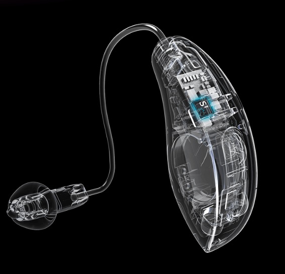 Starkey hearing aid that displays the internal components